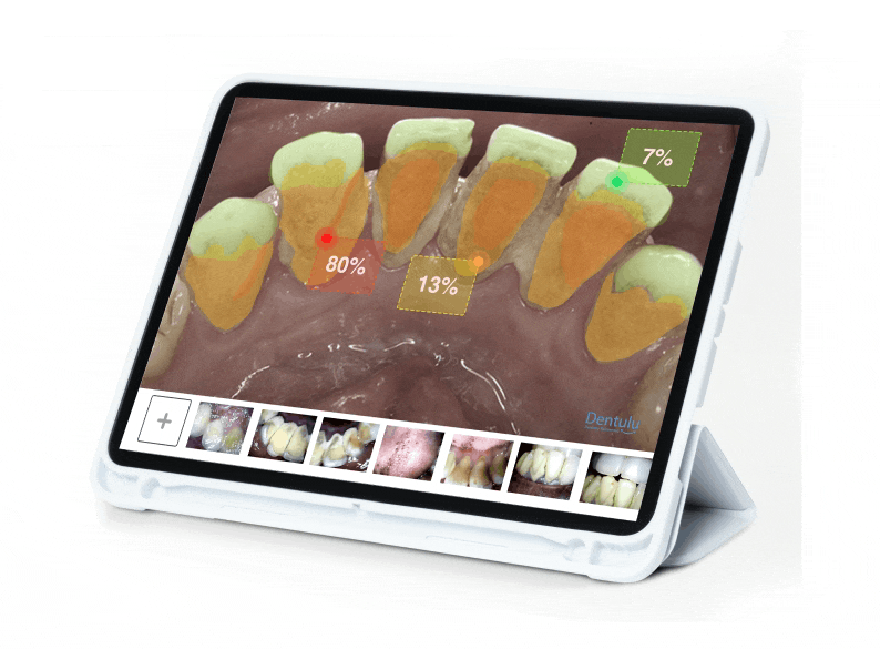 Artificial intelligent teledentistry