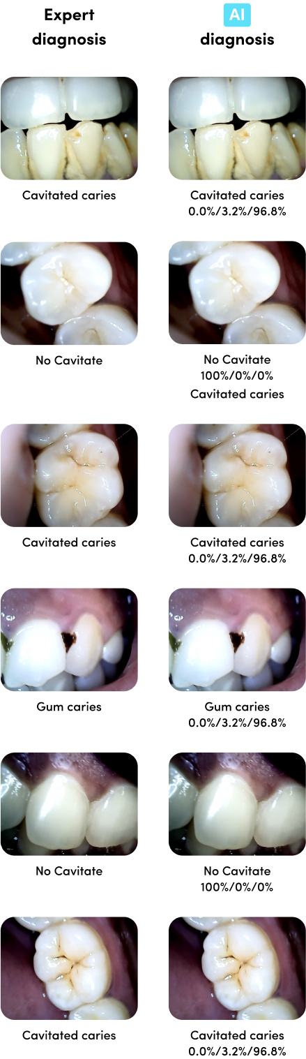 Dentulu