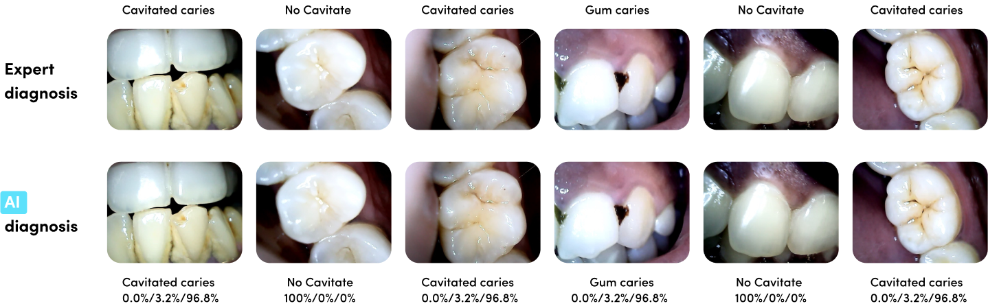 Dentulu