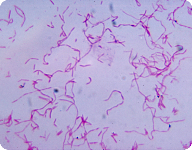 What is Fusobacterium nucleatum?