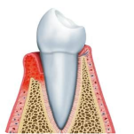 Endodontist