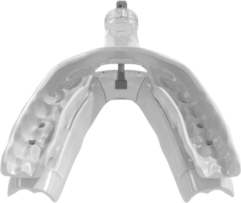 Sleep Apnea Mouth Guards