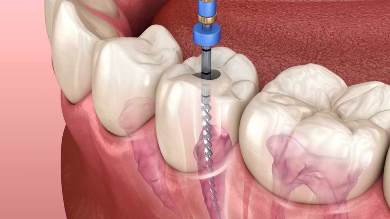 Endodontics