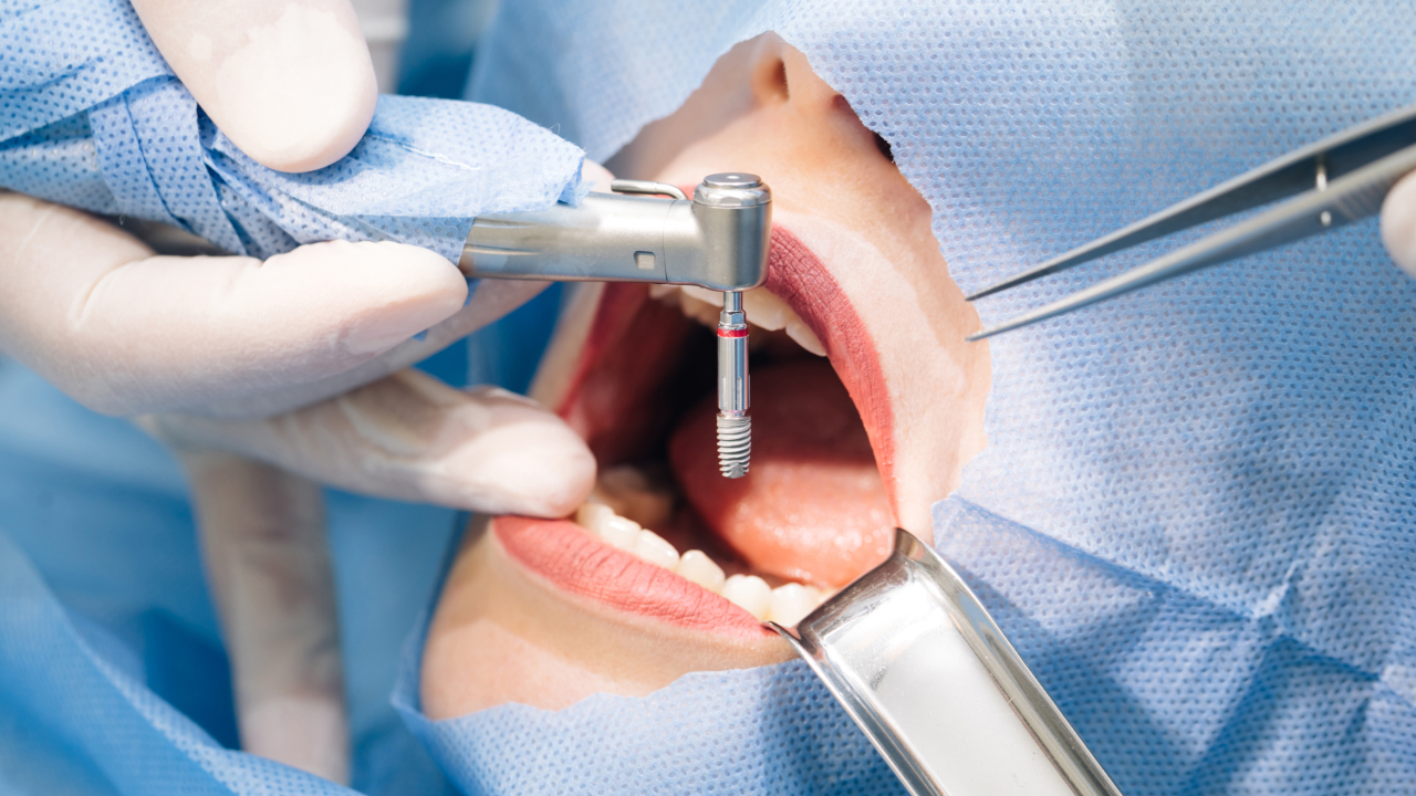 Patient Education Videos | Dentulu | Patient Education Demo