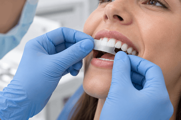 Dental professional applying the first CrystLCare Regeneration+ strip