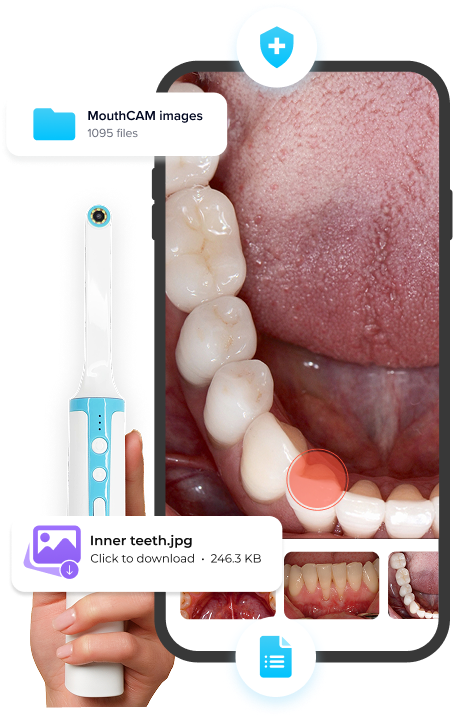 MouthCAM Professional