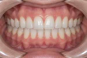 Example of taking a dental photo in good lighting