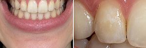 Example showing wide and close-up dental photos