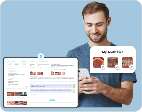 MouthCAM Intraoral Camera