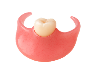 Single Tooth Valplast