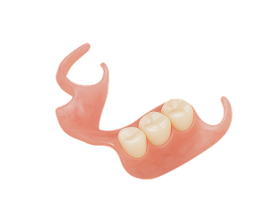 Transitional Valplast