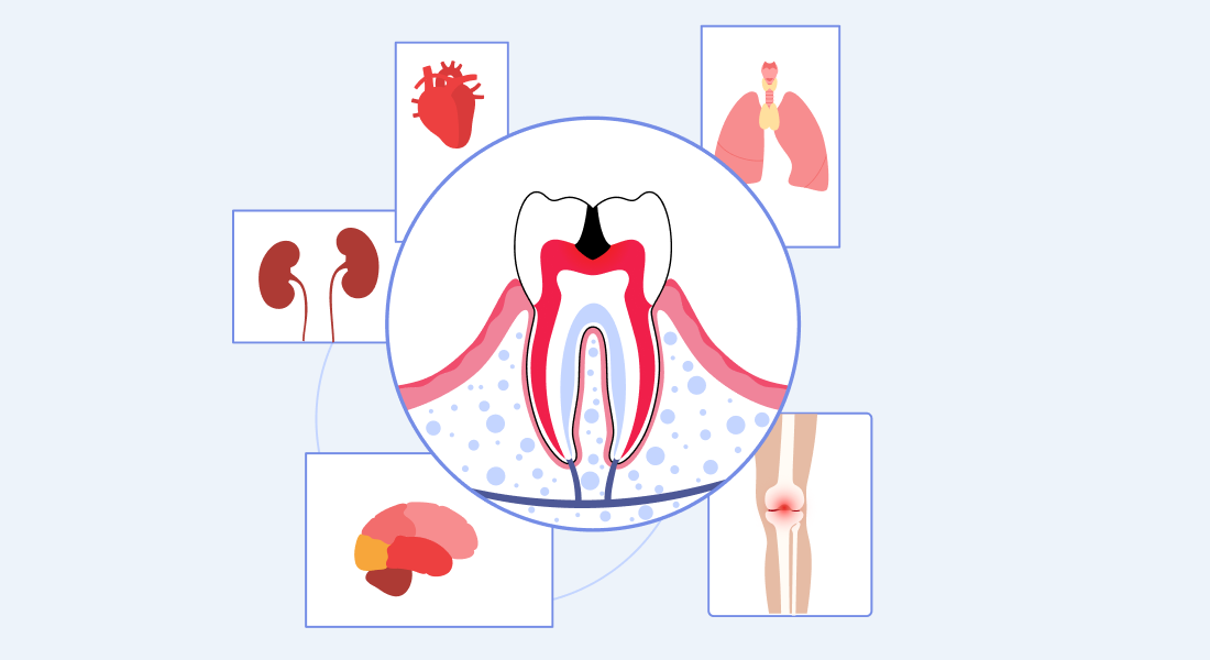 Oral Health