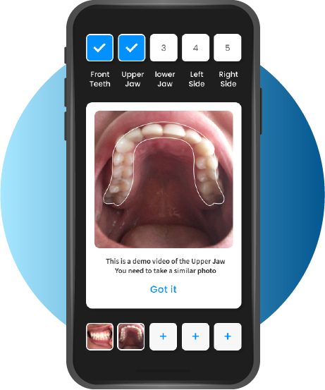 Toothlens AI