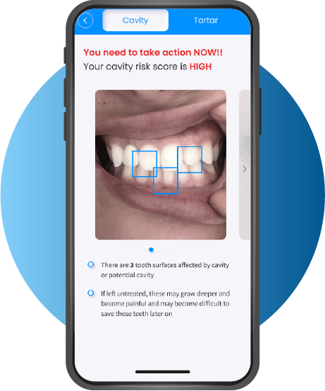 Toothlens AI