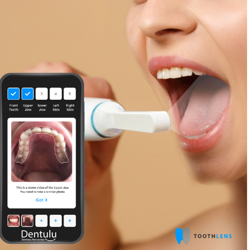 Toothlens AI