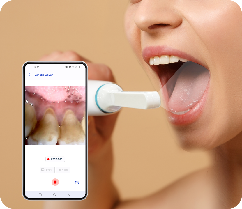 Toothlens AI